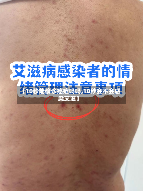 【10秒能确诊癌症吗吗,10秒会不会感染艾滋】