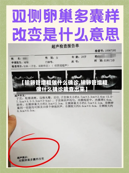【输卵管增粗做什么确诊,输卵管增粗做什么确诊能查出来】