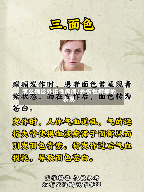 怎么确诊外伤性癫痫/外伤性癫痫的表现