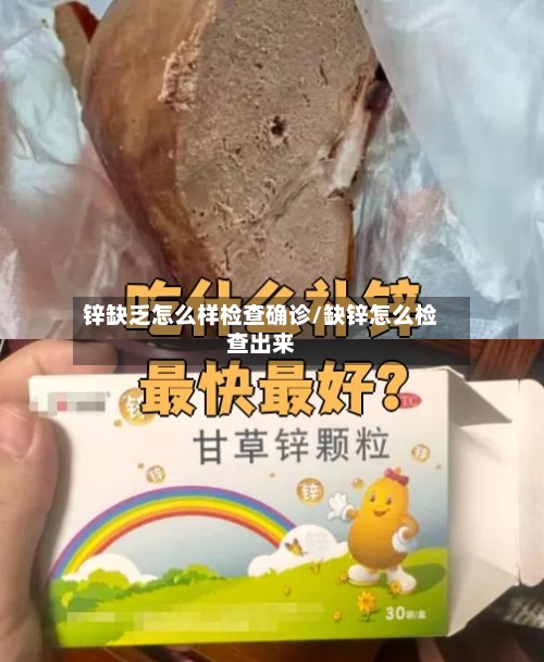 锌缺乏怎么样检查确诊/缺锌怎么检查出来-第3张图片
