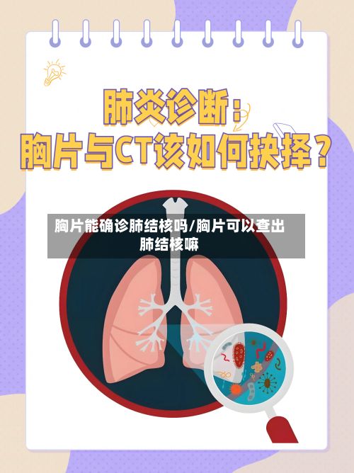 胸片能确诊肺结核吗/胸片可以查出肺结核嘛-第2张图片