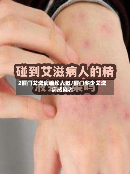2厦门艾滋病确诊人数/厦门多少艾滋病感染者