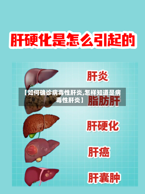 【如何确诊病毒性肝炎,怎样知道是病毒性肝炎】